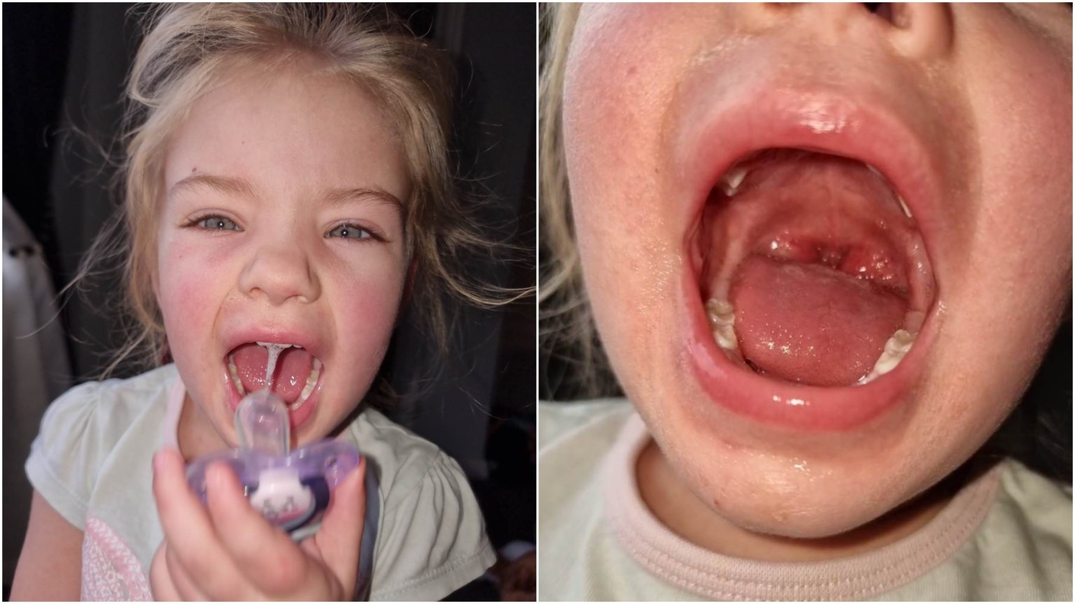 toddler-diagnosed-with-strep-a-lincoln-mum-shares-experience