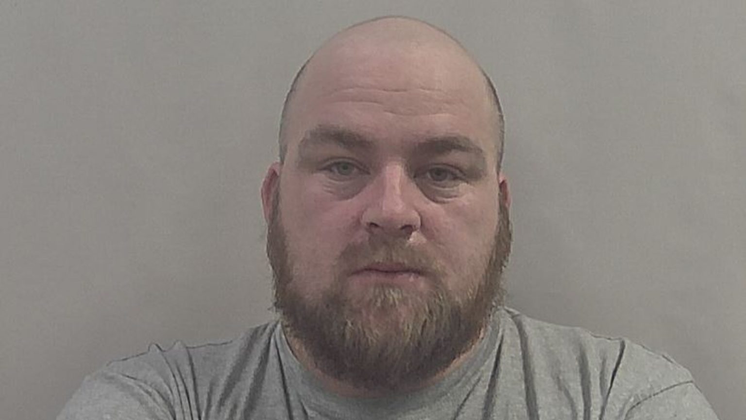 Man Jailed After Punch Left Victim With Fractured Skull And Brain Injury